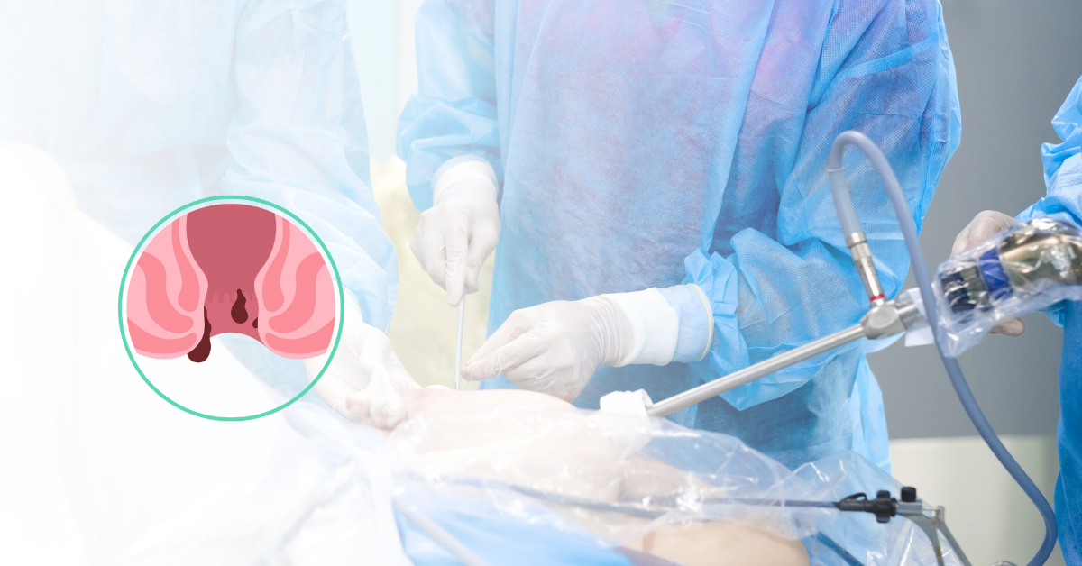 Top 5 Technologies Used in Fistula Surgery 